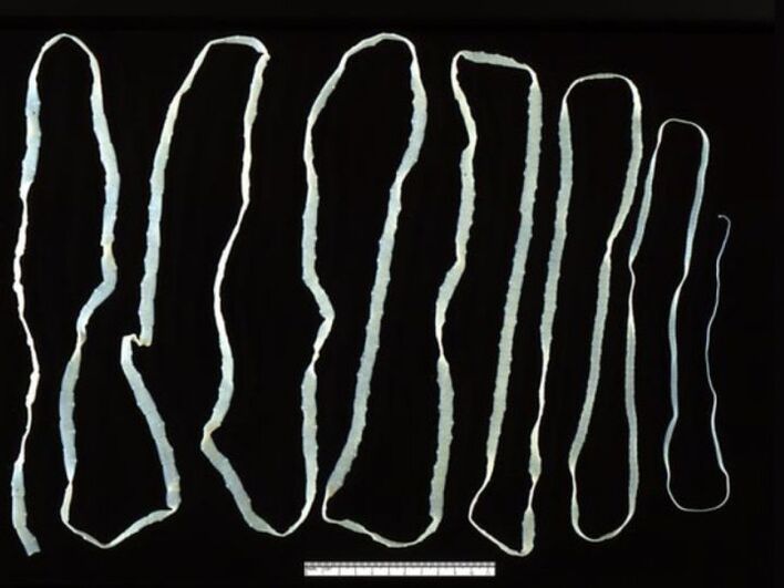 Bovine tapeworm