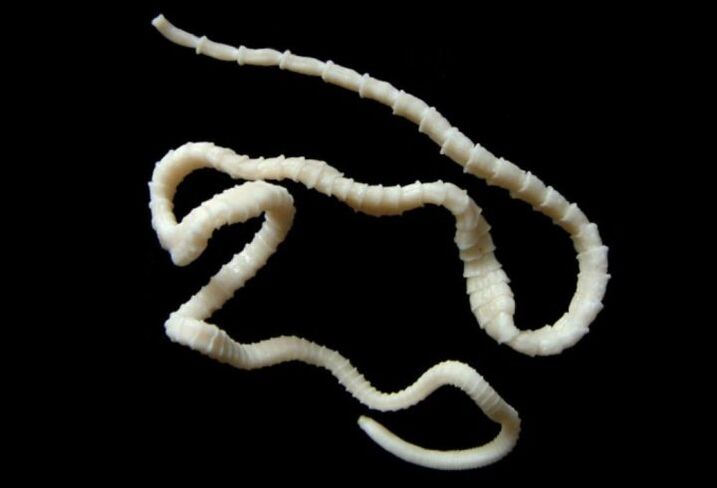 Large tapeworm