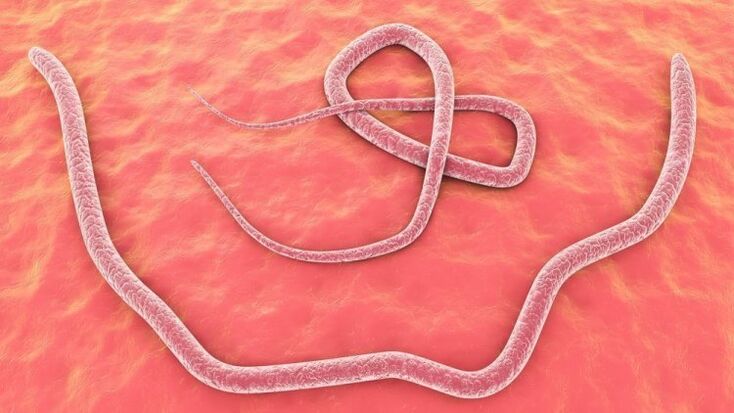 roundworm in human body
