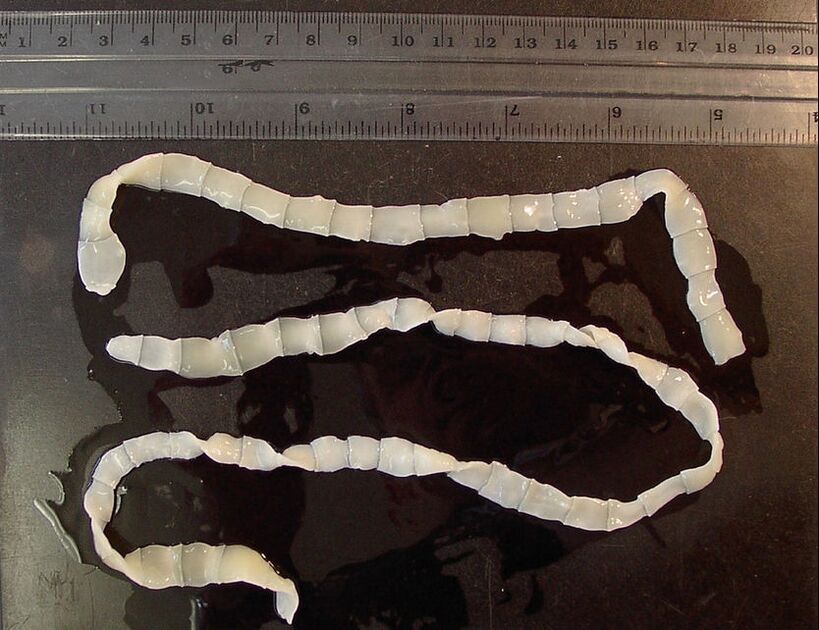 large tapeworm in human body