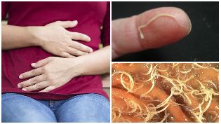 worms in the human body