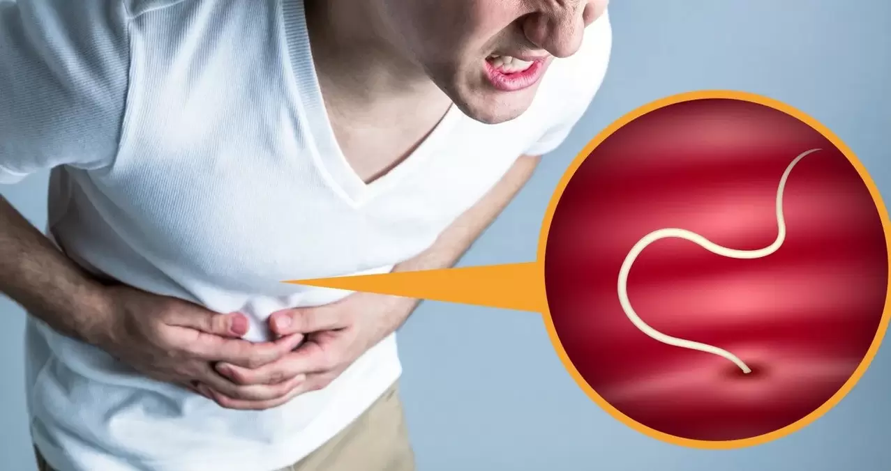 abdominal pain due to parasites